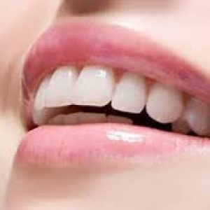Niềng răng nên sử dụng loại mắc cài nào là tốt nhất? Mỗi mắc cài đều có ưu và nhược điểm khác nhau vì thế tùy vào nhu cầu và kinh tế của mỗi người.