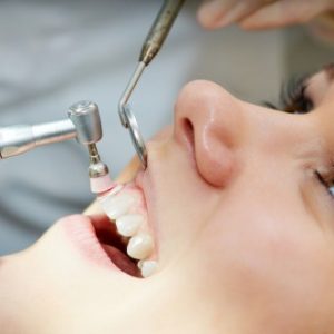 ảnh hưởng của việc niềng răng