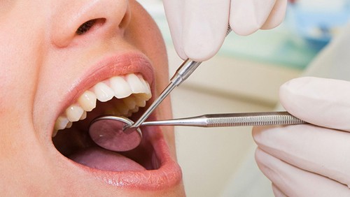 Quy trình chữa tủy răng tại Vinh