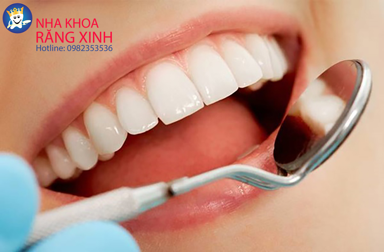 Bọc răng sứ giá rẻ chất lượng cao tại Vinh