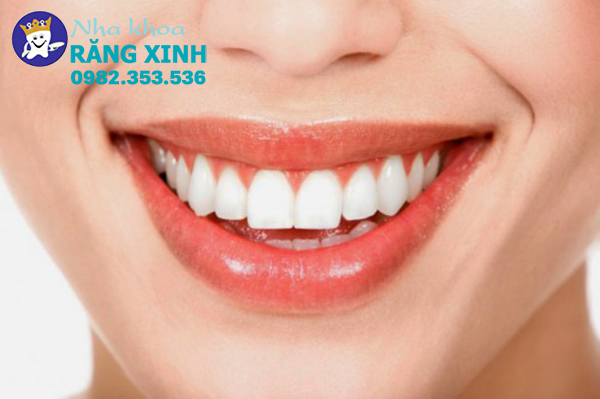 dich vu tay trang rang nhanh tai ha tinh đep va tham my nhat hien nay